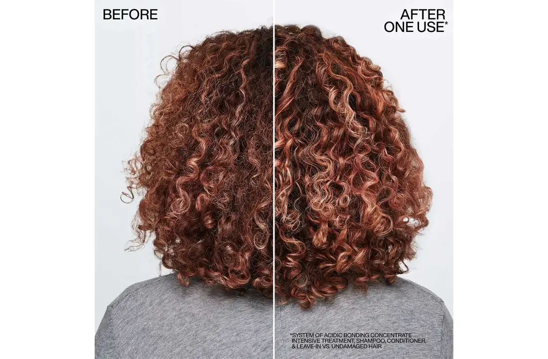Acidic Bonding Concentrate Pre-Treatment - 150ml