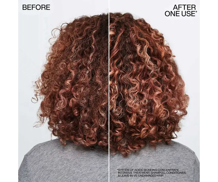 Acidic Bonding Concentrate Pre-Treatment - 150ml